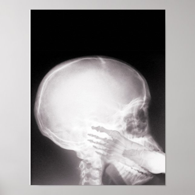 Foot in Mouth X-Ray Poster (Front)