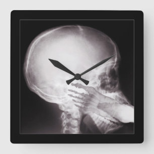 Foot in Mouth X-Ray Square Wall Clock