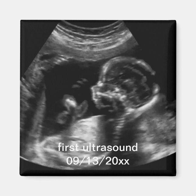 For New Mother First Ultrasound Sonogram Baby Magnet (Front)