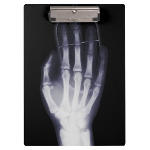 Funny Hand X-ray For internet addictioner Clipboard