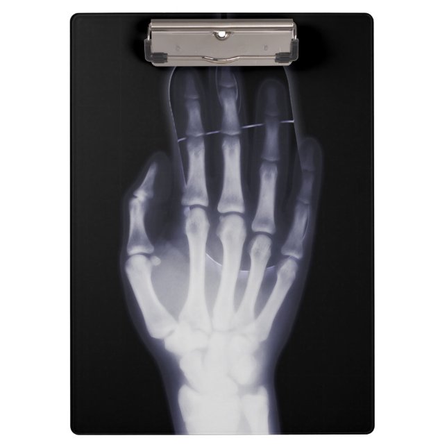 Funny Hand X-ray For internet addictioner Clipboard (Front)