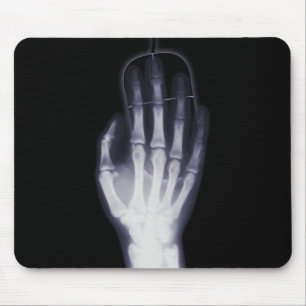 Funny Hand X-ray For internet addictioner Mouse Mat