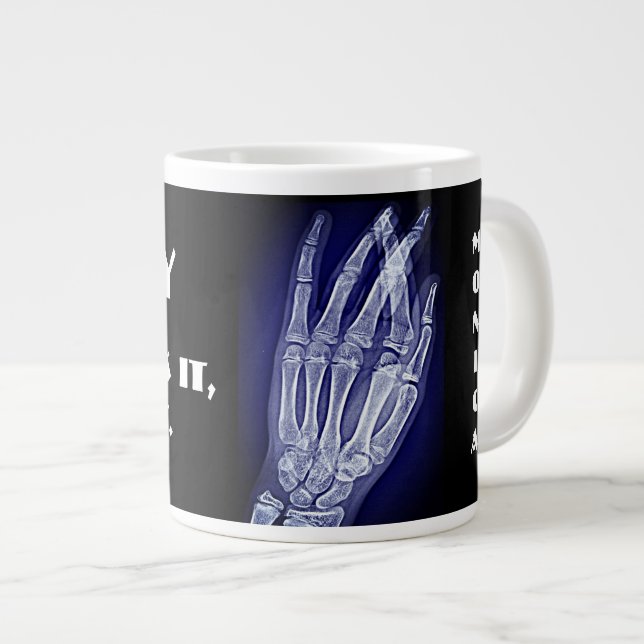 Funny"X-ray. You Break it, I Take It" & Hand Xray Large Coffee Mug (Front Right)