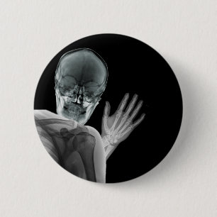 Funny Xray Photobomb 6 Cm Round Badge