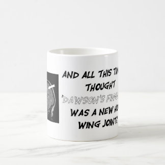 Get Personal With Your Lesion Load! Coffee Mug