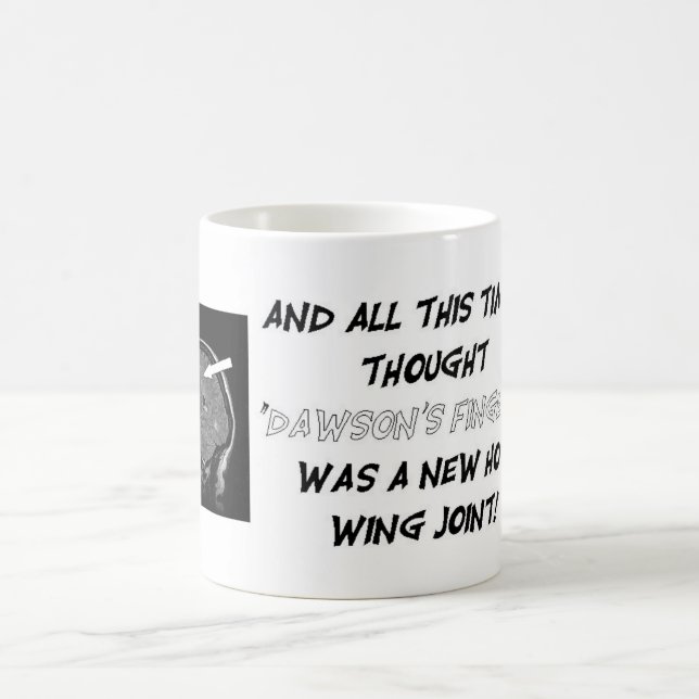 Get Personal With Your Lesion Load! Coffee Mug (Center)