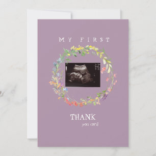 Girl Ultrasound Photo Thank You Baby Point of View