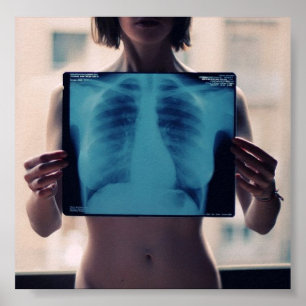 girls chest x-ray poster