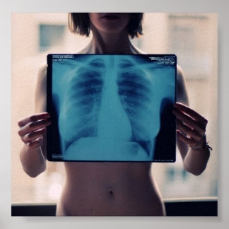 girls chest x-ray poster