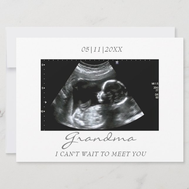 Grandma's New Grandbaby Ultrasound Announcement (Front)