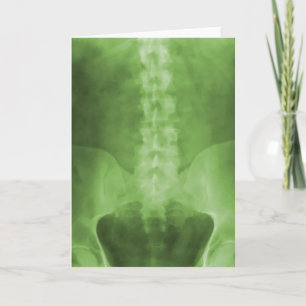 Green Digital X-Ray Art Greeting Card