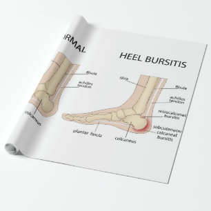 Haglund's deformity wrapping paper