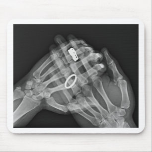 Hand Holding Mouse Mat