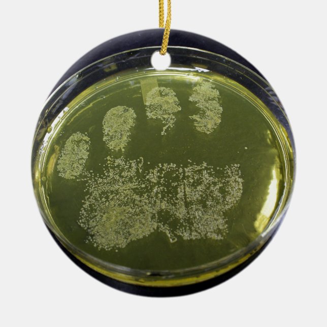Hand Petri Dish Bacteria Ceramic Tree Decoration (Front)