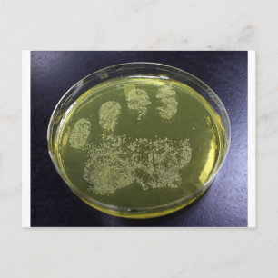 Hand Petri Dish Bacteria Postcard
