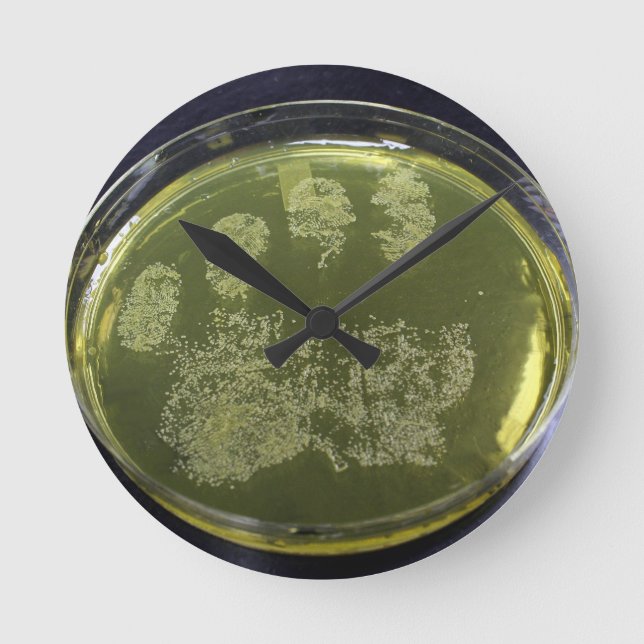 Hand Petri Dish Bacteria Round Clock (Front)