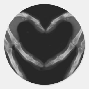 Hand X Ray Classic Round Sticker