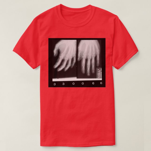 Hands Xray actual 1960s xray T-Shirt (Design Front)