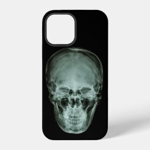 Head Skull X-Ray iPhone 12 Case
