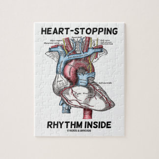 Heart-Stopping Rhythm Inside Anatomical Heart Jigsaw Puzzle