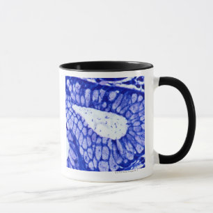 Helicobacter Pylori Mug