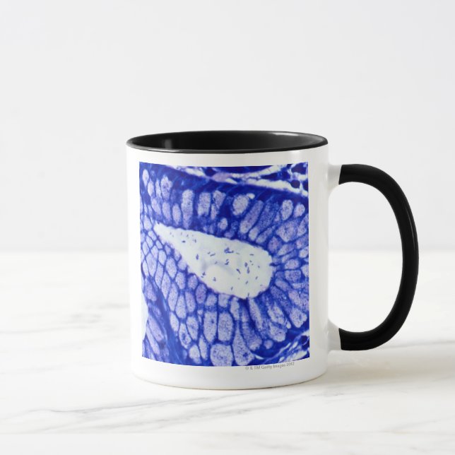 Helicobacter Pylori Mug (Right)