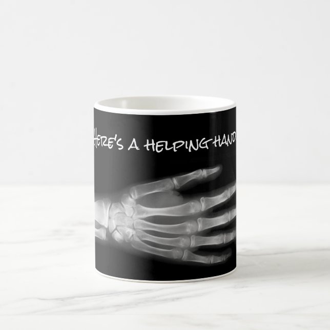 "Here's a helping hand!" hand xray Coffee Mug (Center)