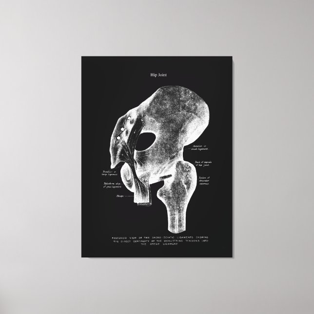 Hip Joint Anatomy Medical Large Canvas Art (Front)