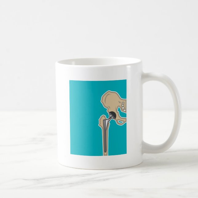 Hip Joint Replacement Coffee Mug (Right)