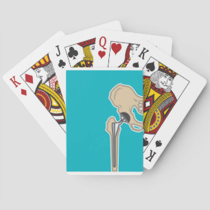 Hip Joint Replacement Playing Cards