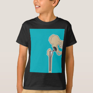Hip Joint Replacement T-Shirt