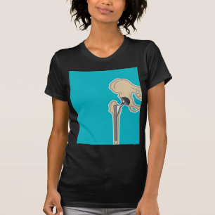 Hip Joint Replacement T-Shirt