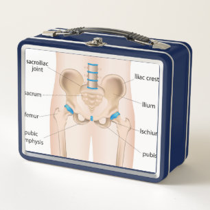 Hip pain bursitis metal lunch box