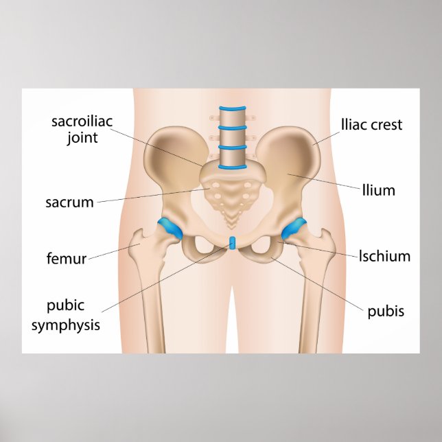 Hip pain bursitis poster (Front)