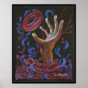 Hope - Sickle Cell Art Print