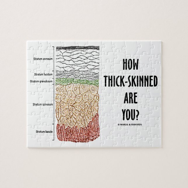 How Thick-Skinned Are You? (Epidermis Skin Layers) Jigsaw Puzzle (Horizontal)