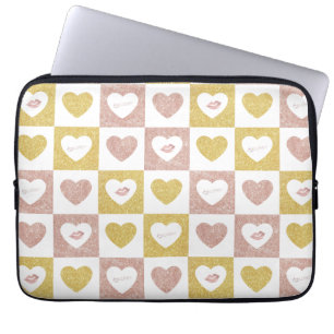 hug and kisses laptop sleeve