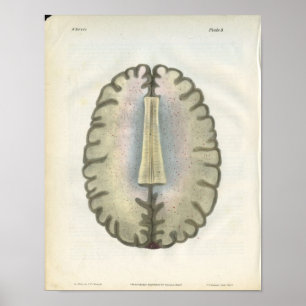 Human Brain Anatomy Print