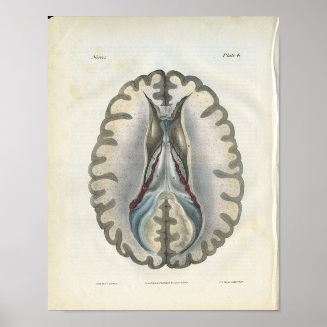 Human Brain Section Vintage Anatomy Print (Front)