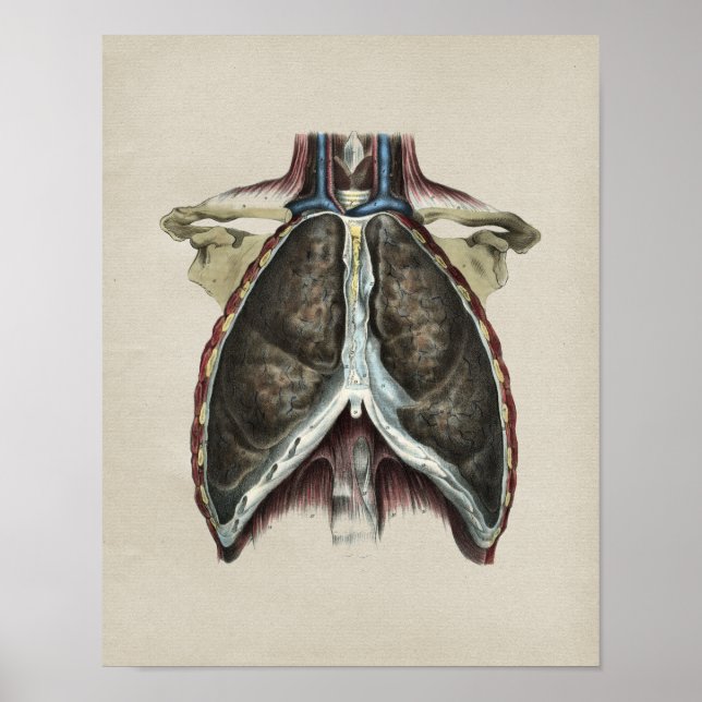 Human Chest Lung Anatomy Vintage Print (Front)