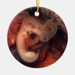 Human Embryo 7th Week of Pregnancy 5th Peek P.O. Ceramic Tree Decoration