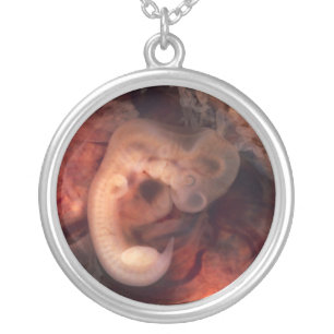 Human Embryo 7th Week of Pregnancy 5th Peek P.O. Silver Plated Necklace