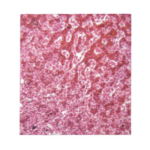 Human liver cells with cancer notepad