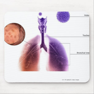 Illustration of an asthma attack from pollen mouse mat
