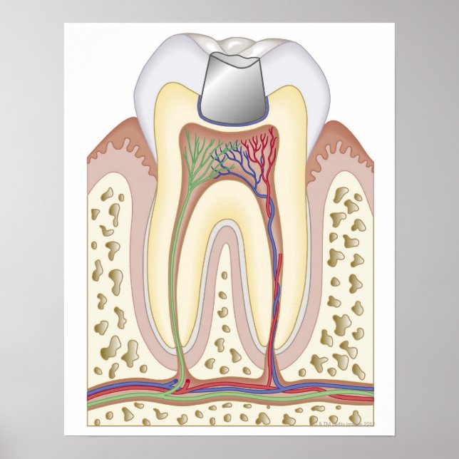 Illustration of Dental Filling Poster (Front)