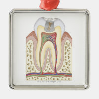 Illustration of Tooth Decay