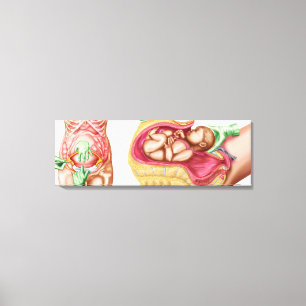Illustration Showing Caesarean Delivery Of Foetus Canvas Print