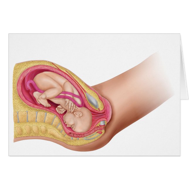 Illustration Showing Delivery Of Foetus 2 (Front Horizontal)