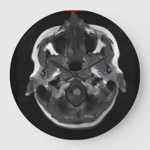 im in your head xray mri scan medical large clock