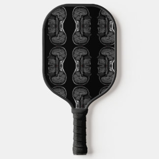 im in your head xray mri scan medical pickleball paddle